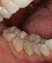 TERAN Dental Co. image 17