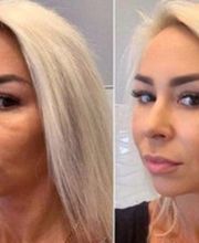 Future Beauty by Troxler Bild 7