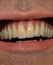 Clínica Implanteoral Milladoiro imagen 16