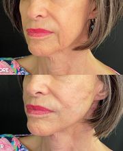 360 Surgery Center image 5