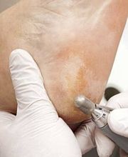 PodoAkitve Berlin Bild 11