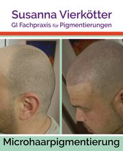 MicrohaarPigmentierung