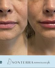 Sonterra Dermatology image 1