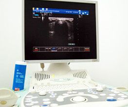 Ultraschalluntersuchung-Sonographie