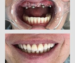 Aniceto Odontologia imagen 3