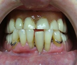 Clínica Implanteoral Milladoiro imagen 15