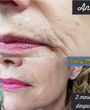 Pies y Manos imagen 1