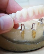Dental-Labor Handrich GmbH Bild 2