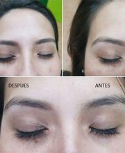 Royal Depil India imagen 13