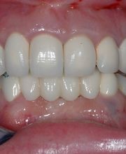 Bodensee Implantatzentrum Dr. Wolfgang Prinz MDSc Zahnarzt/ Implantologie Bild 5