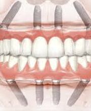 CLINICA DENTAL CEID imagen 5