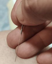 Acupuntura Yolanda Dorado imagen 14