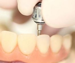 centre-odontologia-miret-puig-implantologia-05.jpg