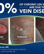 Center for Vein Restoration | Dr. Mohamed Hassan image 16