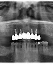 Draper Dental image 7