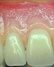 Atelier Dentaire Numérique A.D.N image 5