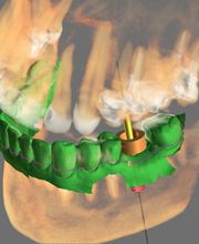 Providence Dental Spa | East Cobb image 5