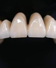 clinica-dental-herpaden05.jpg