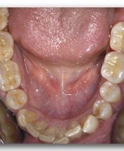 Dr. med. dent. Meier Daniel Bild 3