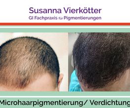 Microhaar Verdichtung 23