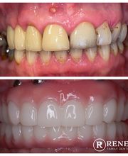 Renew Family Dentistry image 17