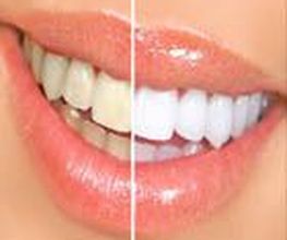 Clínica Implanteoral Milladoiro imagen 18