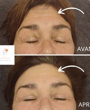 NT esthetics image 5