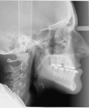 Clínica Dental Vitaldent imagen 15