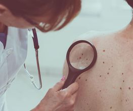 abdermatologia imagen 7