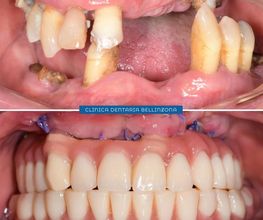 Studio Dentistico Schulthess & Ottobrelli Bellinzona Bild 7