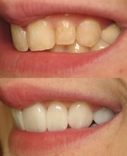 Future of Dentistry - Dracut image 4