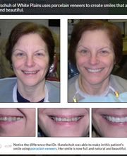 The Dental Design Center - Cosmetic, Implant & General Dentistry image 18