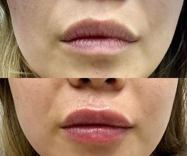 Juvenalia Brío | Botox, Hydrafacial & Ultraformer - Condesa / Roma Norte CDMX imagen 5