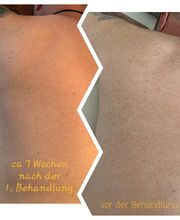 Feel Beautiful by Nicole - Dauerhafte Haarentfernung, Hautverjüngung und Beckenbodentraining Bild 15