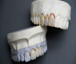 LB PROTHESES DENTAIRES image 1