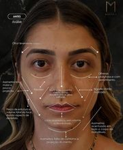 Instituto Marzola | Harmonização Facial imagen 10