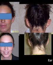 360 Surgery Center image 10