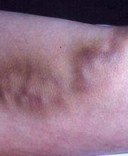 Consulta Barreiro-Vascular (Drs. A. Barreiro Mouro y J. Barreiro Veiguela) imagen 6