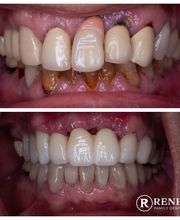 Renew Family Dentistry image 9