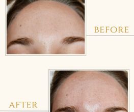 Skintastic Julia Riemer Bild 10
