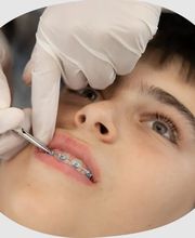 Kieferorthopädie Zürichberg AG, Dr. med. dent. Andreas Galli Bild 2