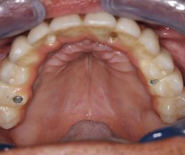 Clínica Implanteoral Milladoiro imagen 8