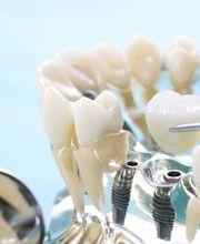 Linder Pro-Dental GmbH Bild 5