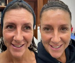 Juvenalia Brío | Botox, Hydrafacial & Ultraformer - Condesa / Roma Norte CDMX imagen 8