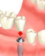 MAITE PÉREZ CORRALES CLÍNICA DENTAL imagen 8