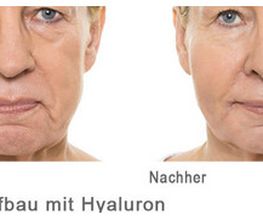Aesthetic Dream by Dr. Cyrus Moghaddam Privatpraxis für Ästhetische Medizin & Kosmetische Chirurgie Bild 15