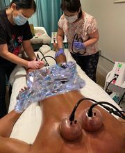 Red Cupping Clinic, LLC image 1
