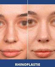 Dr Philippe Legaillard | Chirurgien esthétique Bordeaux | Lifting | Paupières | Rhinoplastie | Augmentation mammaire | Botox image 1