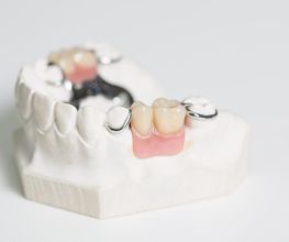 Dentallabor Gunzelmann Bild 3