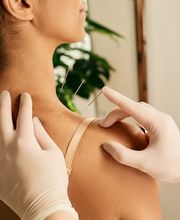 Acupuntura Yolanda Dorado imagen 6